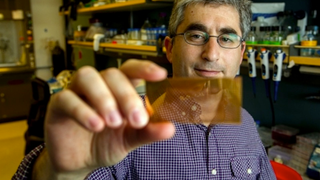 This Tiny, Inexpensive Microchip Can Diagnose Diabetes Instantaneously